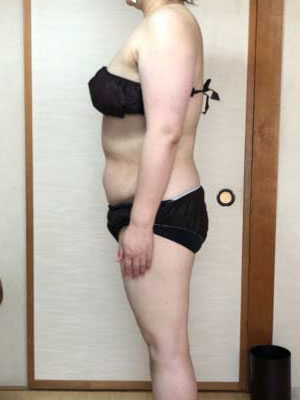 ボディ引き締め 施術後