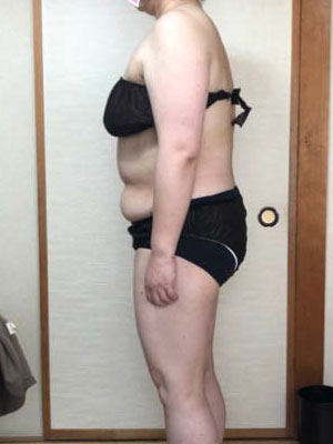 ボディ引き締め 施術前